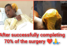 With 70% Completed & 30% Remaining… Sick Pikin Project Appeals for Le37M Support to Complete Medical Treatment Sick Pikin Project,