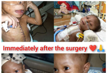 After Successful Surgery in India… Sick Pikin Project Discloses Return of Baby Hassanatu Hale & Hearty Sick Pikin Project