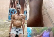 Retired War-Wounded Soldiers in Waterloo Face Growing Humanitarian Crisis Thin man sitting on a doorstep outdoors, shirtless and wearing gray shorts, looking tired or injured.